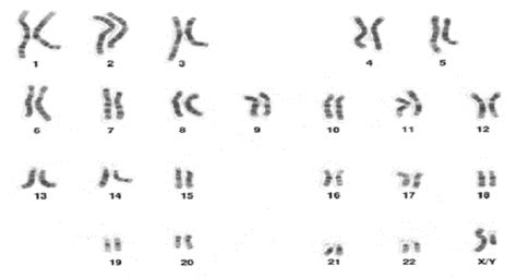 bộ nhiễm sắc thể của người